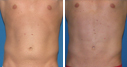 Before & After Photos